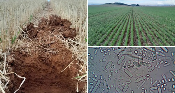 soil microbial activity